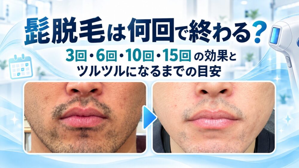 【写真付き】髭脱毛は何回で終わる？回数ごとの効果とツルツルになるまでの目安を解説